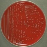 Streptococcus Bovis