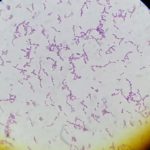 Streptococcus Agalactiae