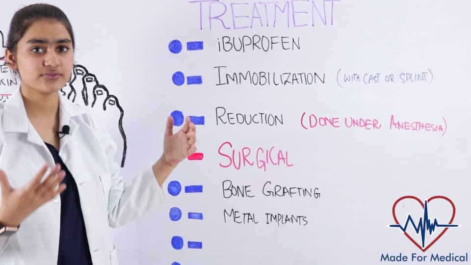 Treatment of Bone Fractures