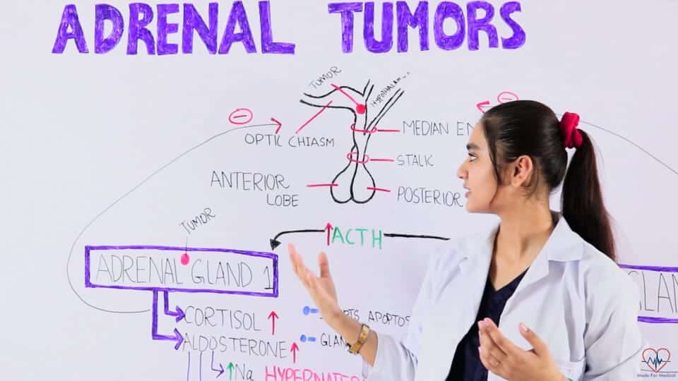Adrenal Gland Tumors