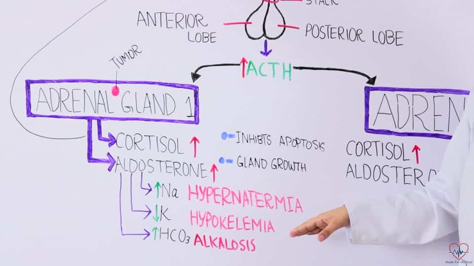 Adrenal gland tumors